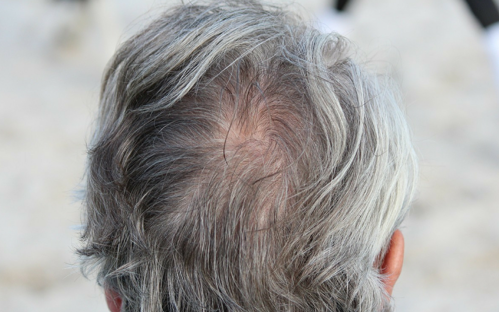 Why Hair Turns Gray and Goes Bald?