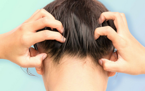 Five Reasons Your Scalp is Itchy